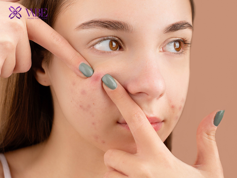 Nếu không biết cách chăm sóc da ở tuổi dậy thì đúng cách, làn da có thể bị tổn thương lâu dài